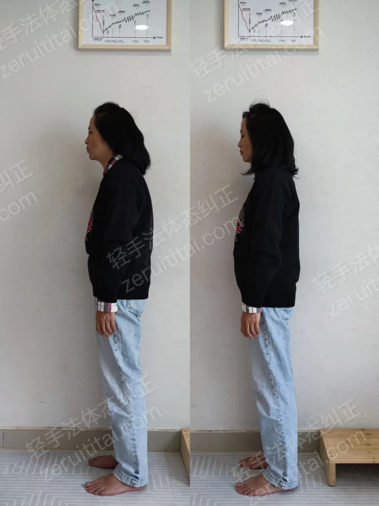 牙科主任职业病脖子前倾纠正