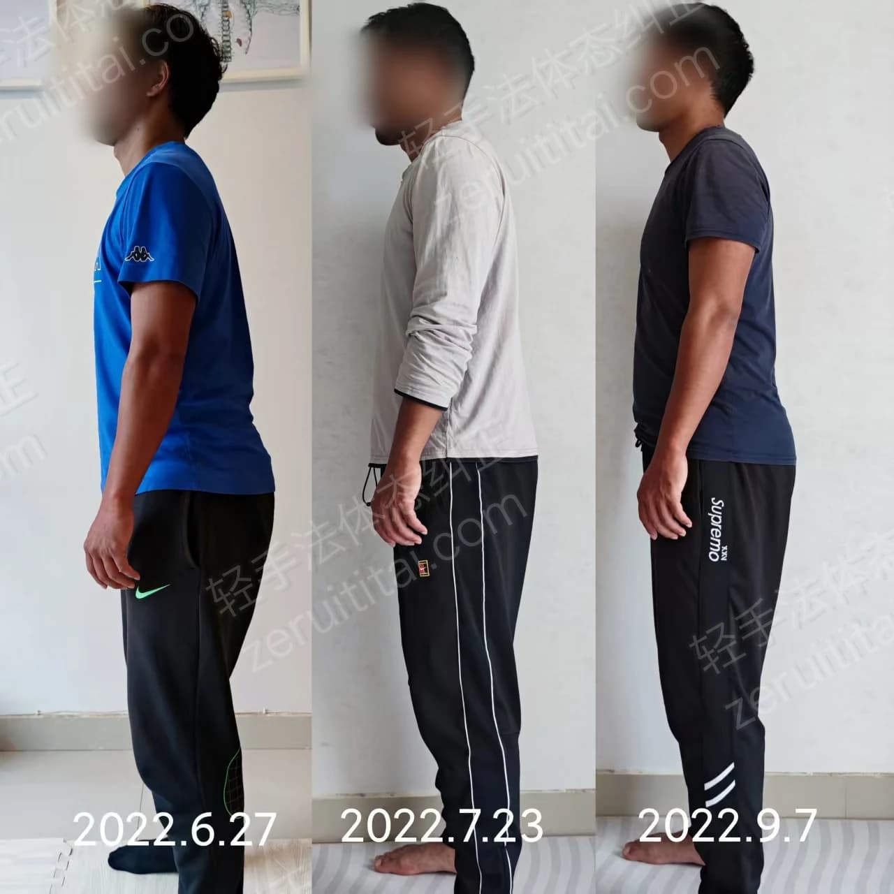 多次矫正阶段对比 03