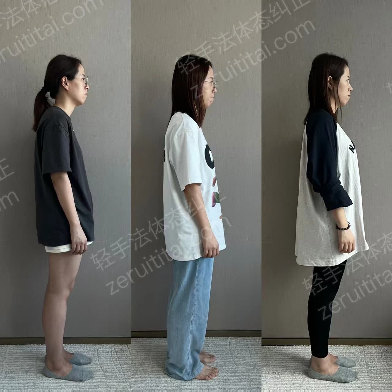 多次矫正阶段对比 06