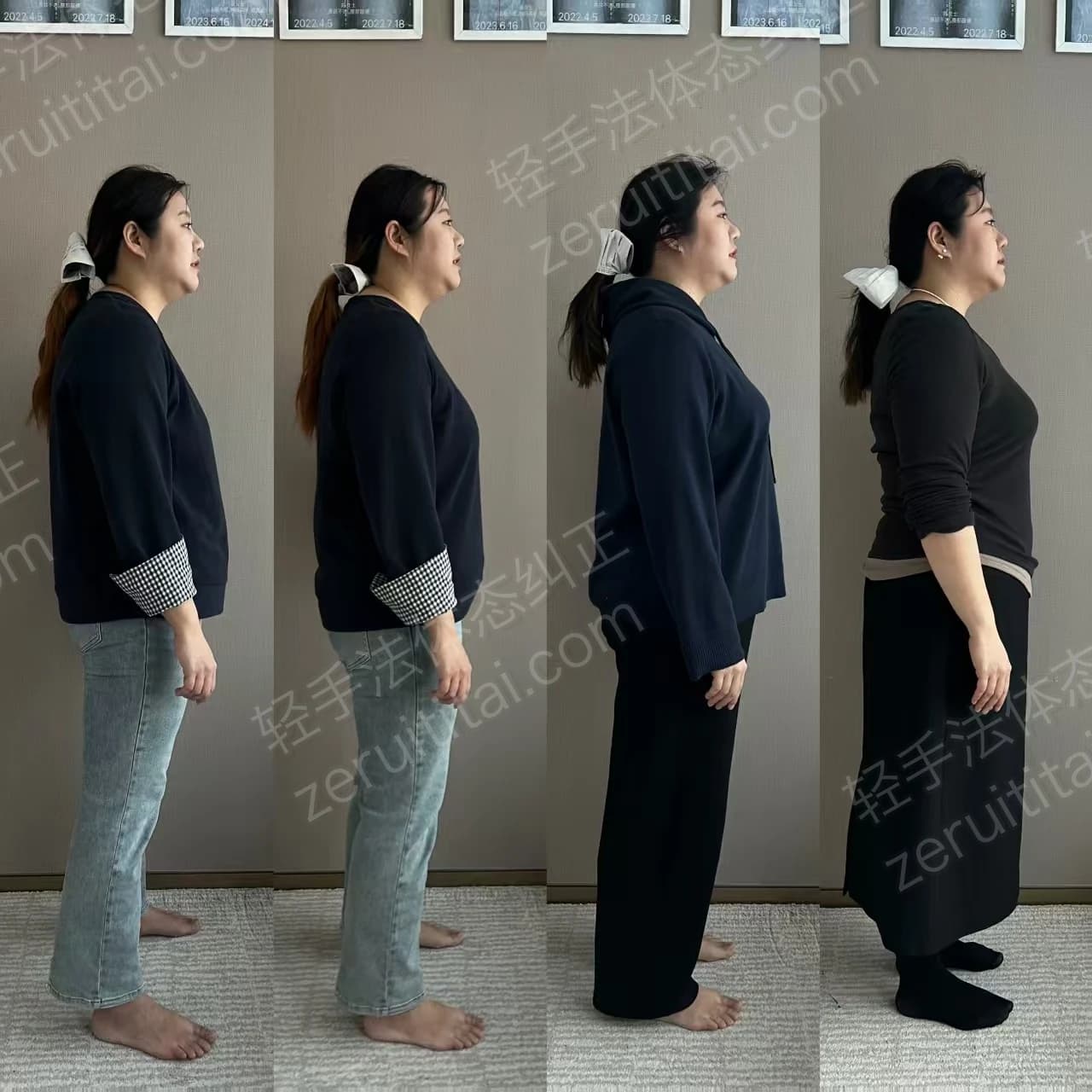 多次矫正阶段对比 09