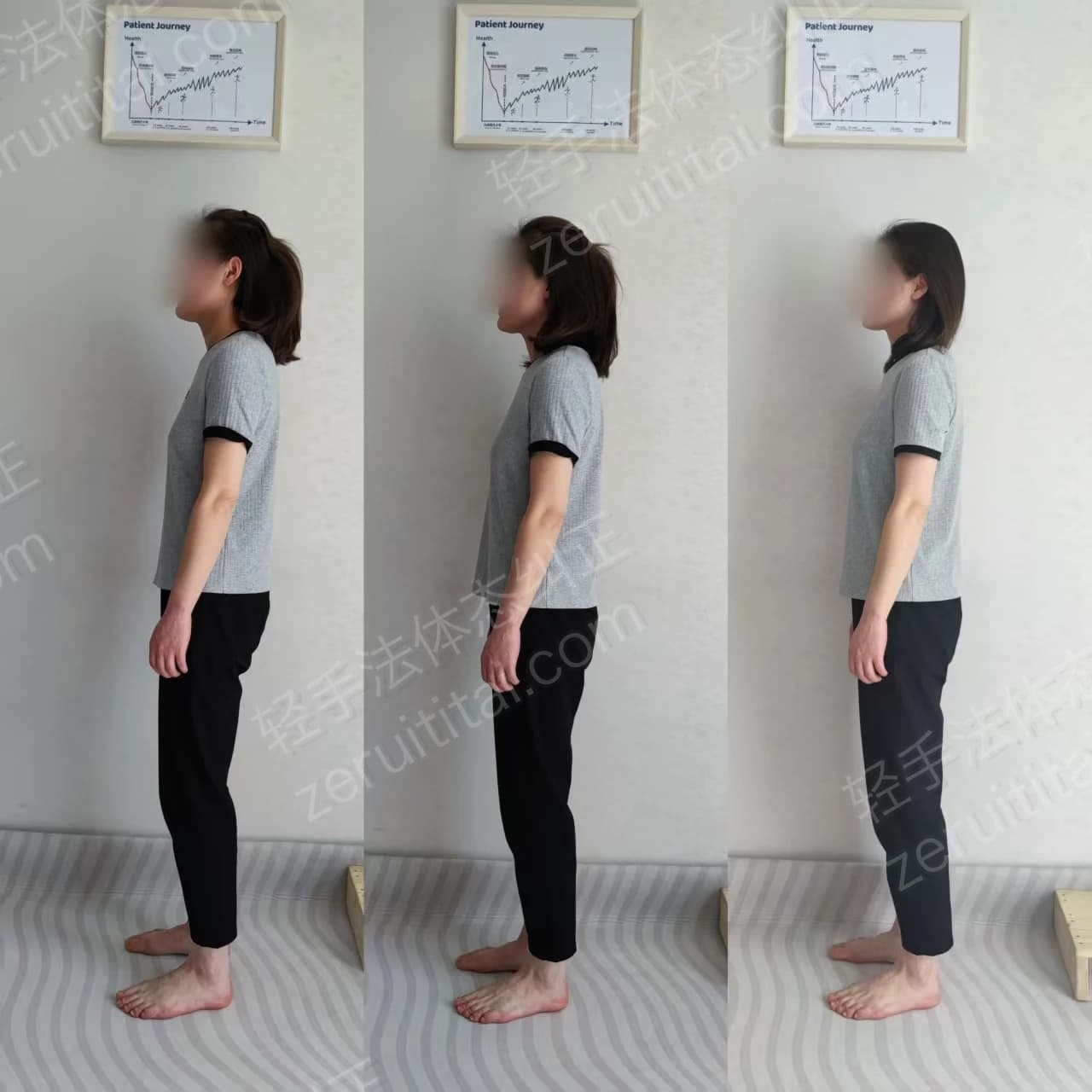 多次矫正阶段对比 10