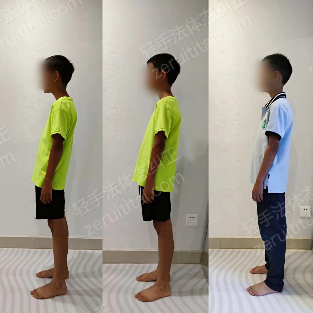 多次矫正阶段对比 12