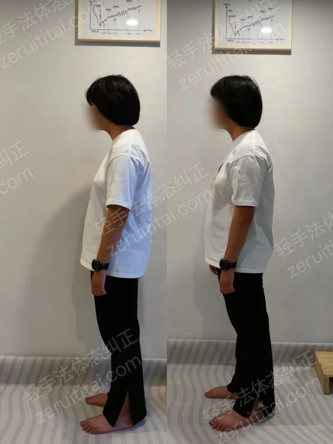 单次矫正案例对比 01