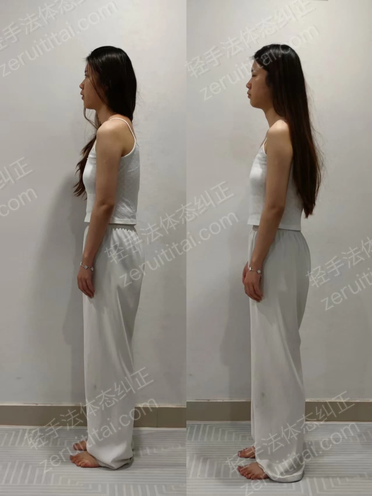 单次矫正案例对比 03