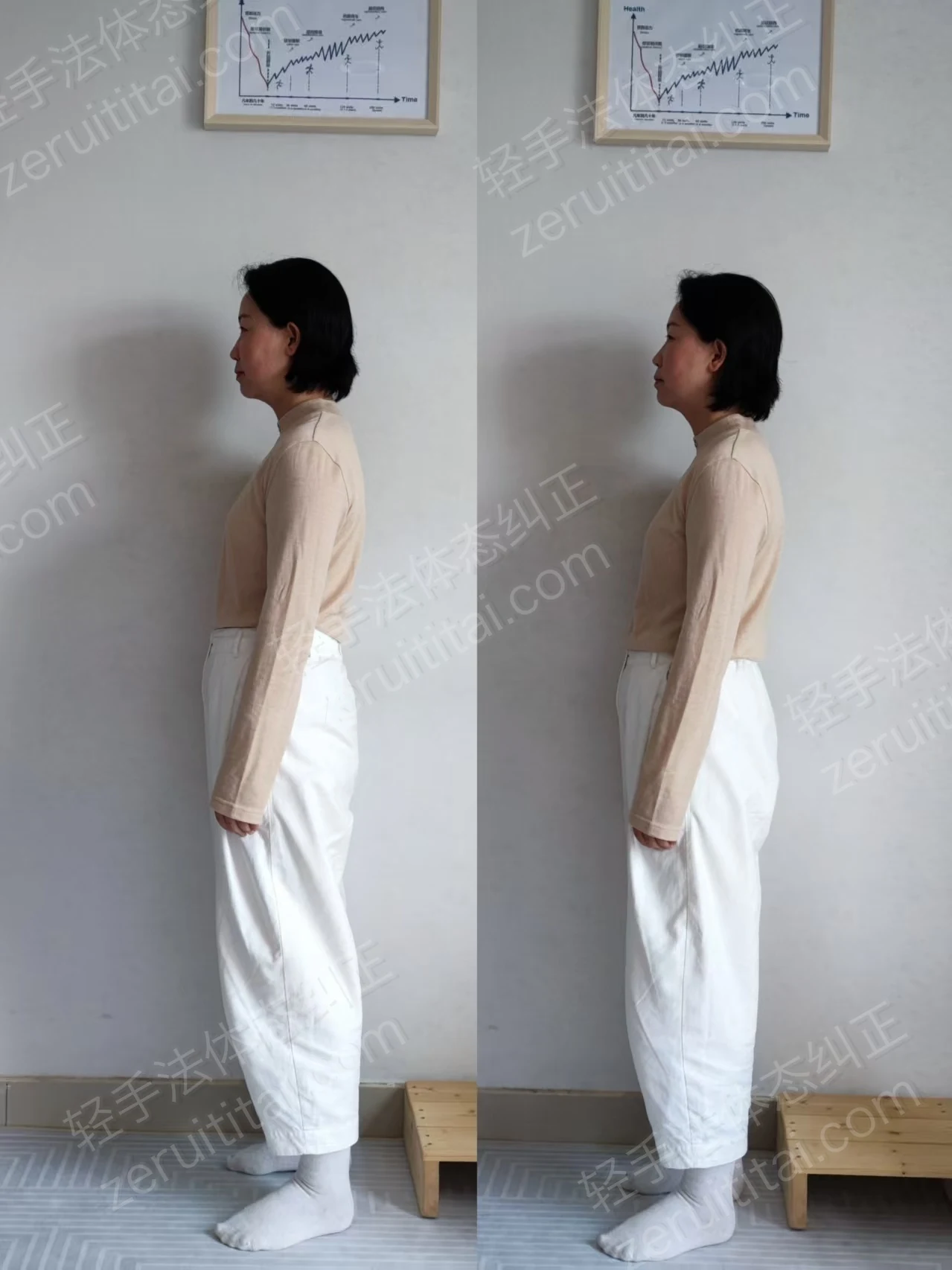 单次矫正案例对比 05