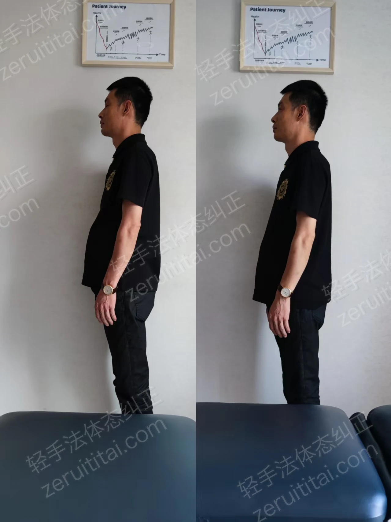 单次矫正案例对比 07