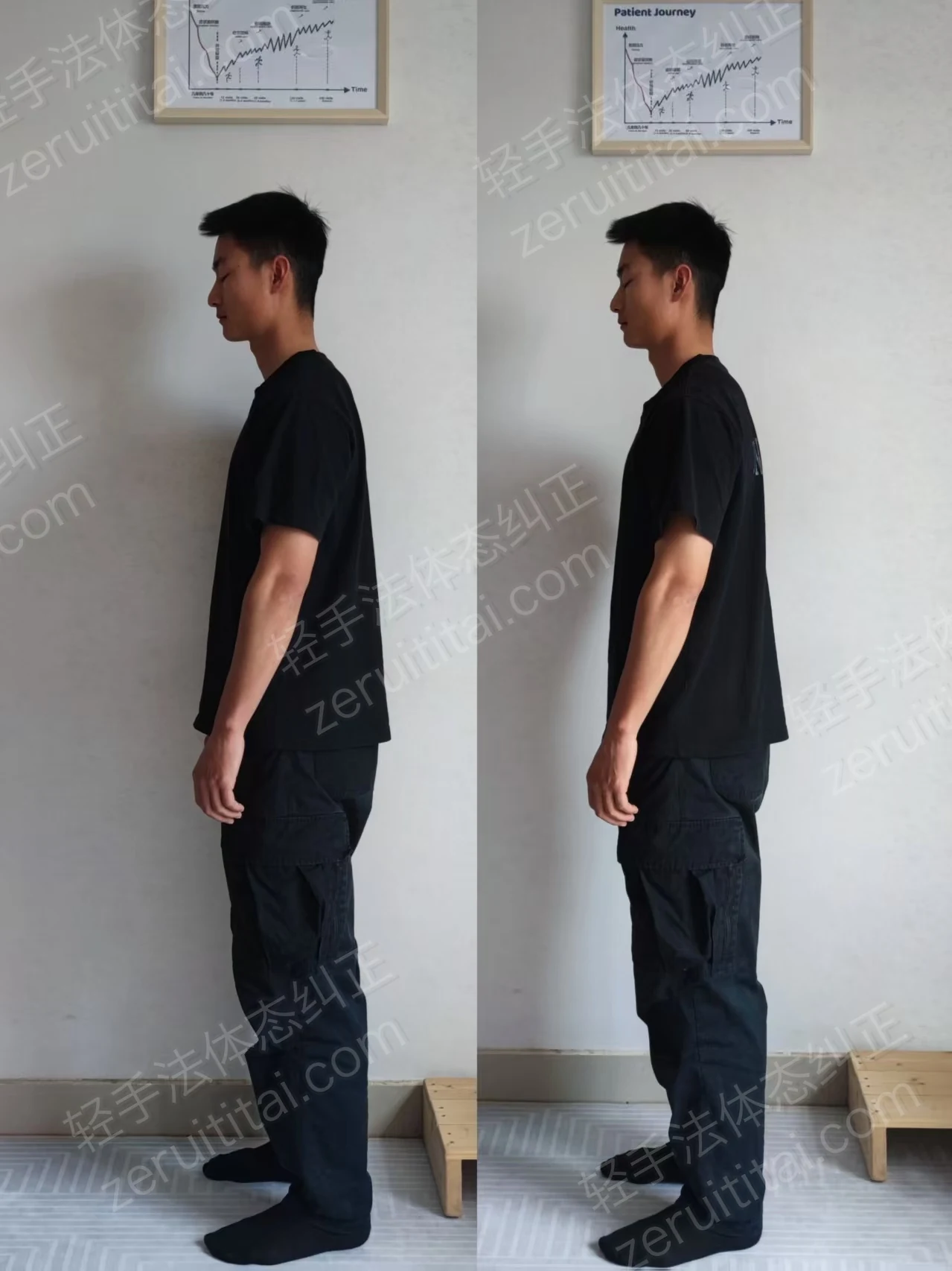 单次矫正案例对比 09