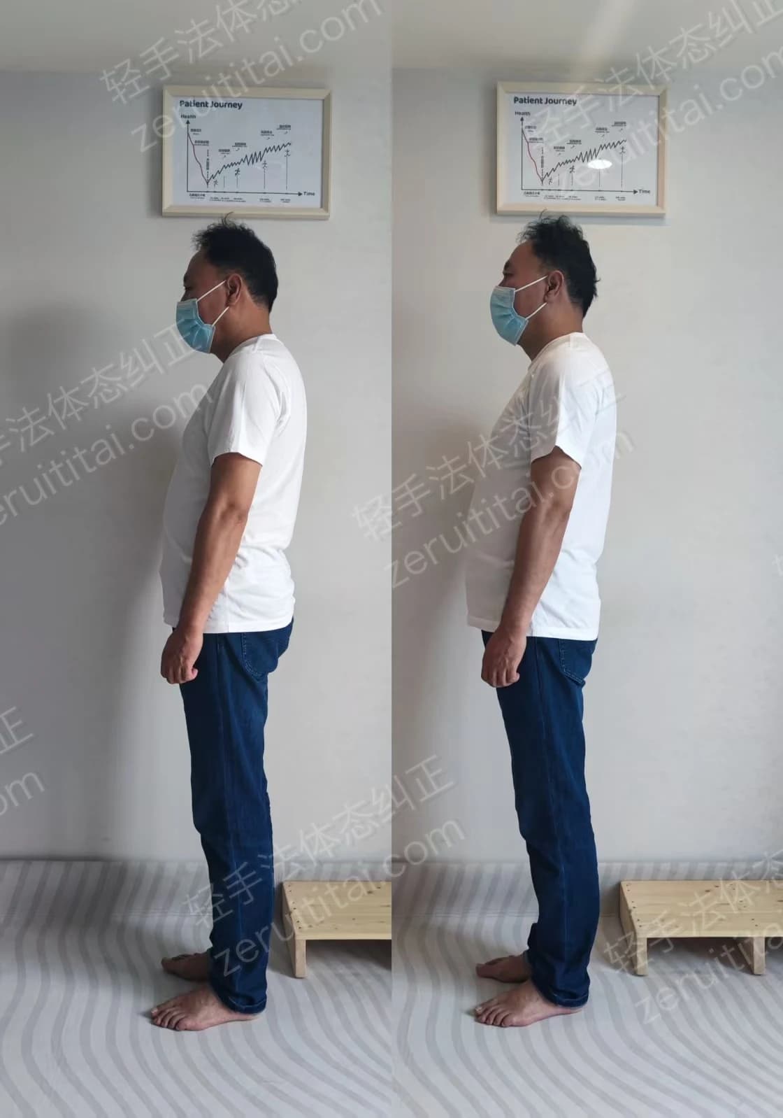 单次矫正案例对比 10