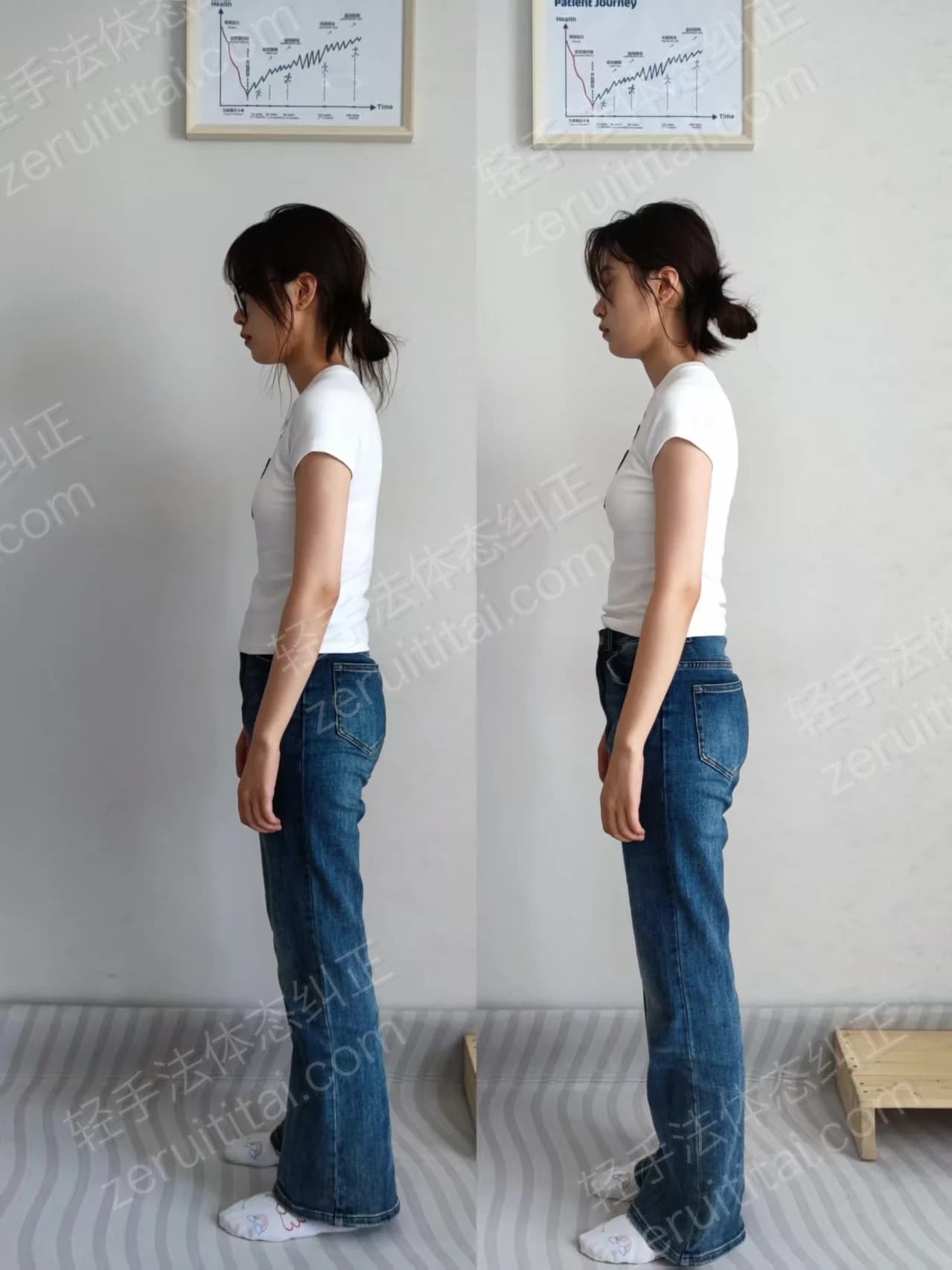 单次矫正案例对比 11