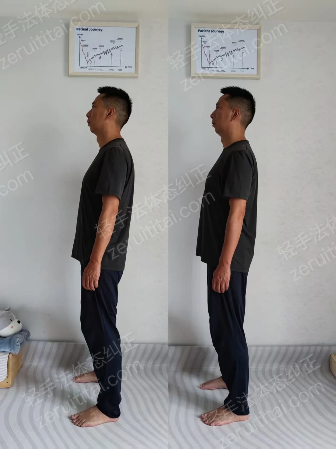 单次矫正案例对比 15