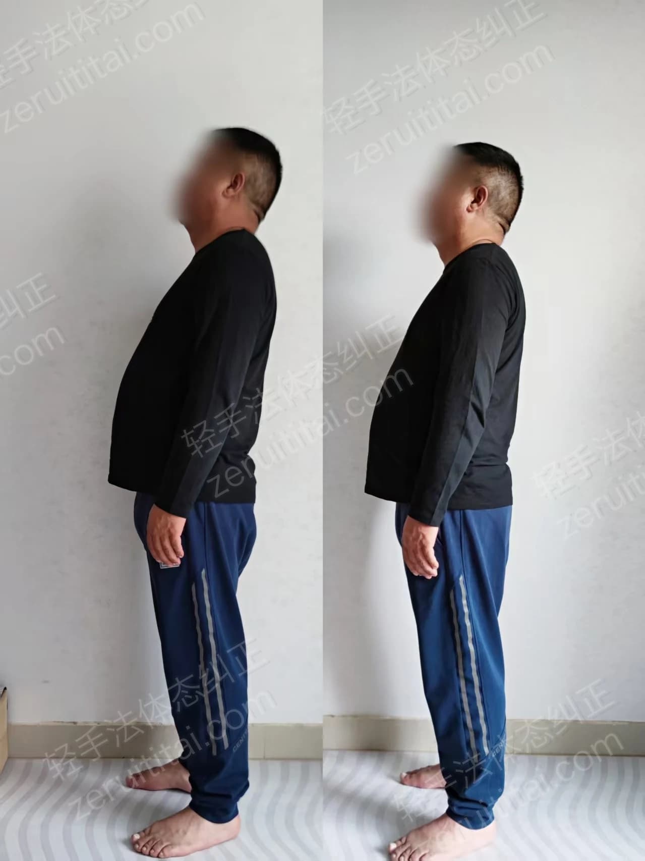 单次矫正案例对比 19