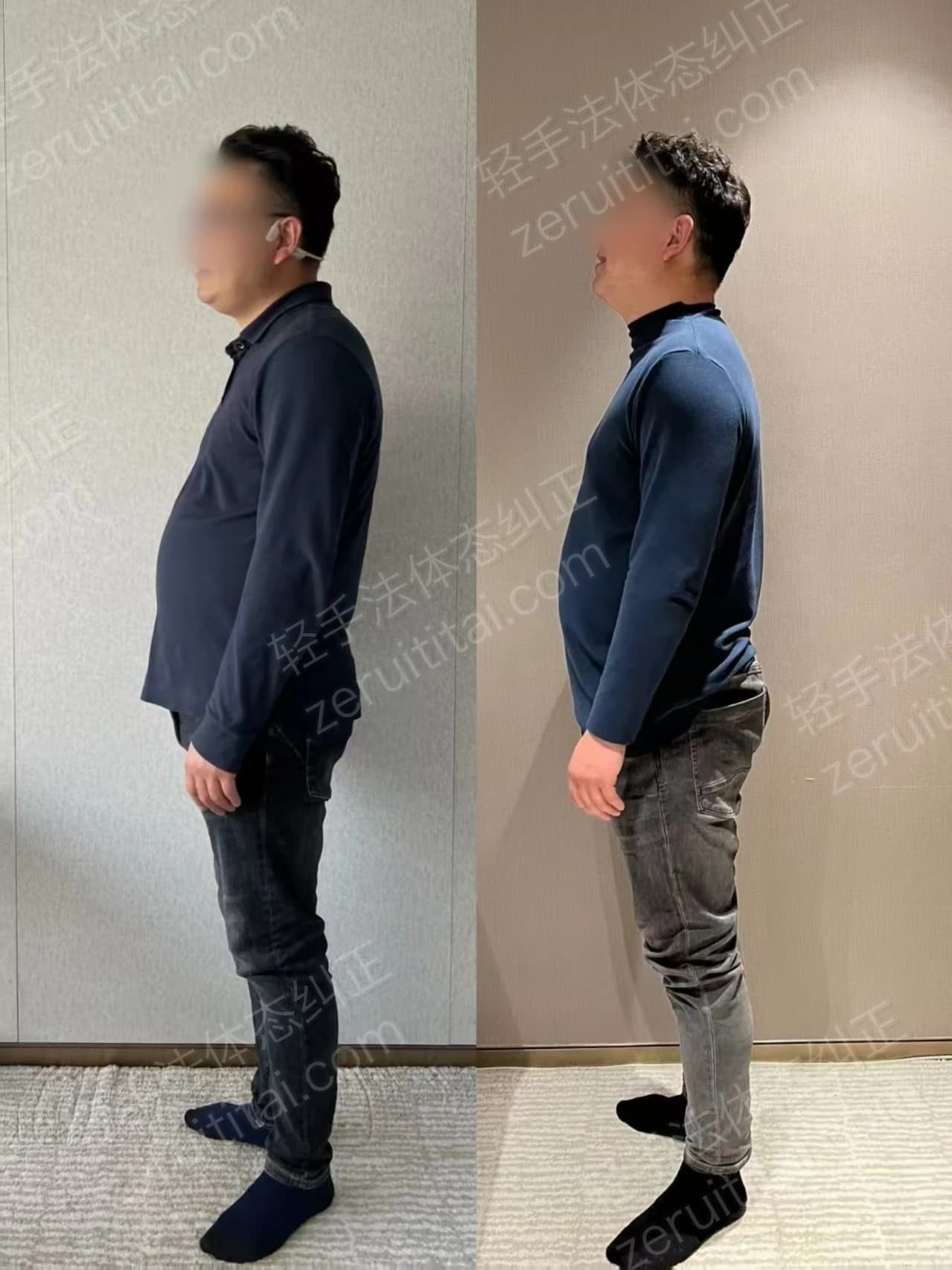 单次矫正案例对比 25