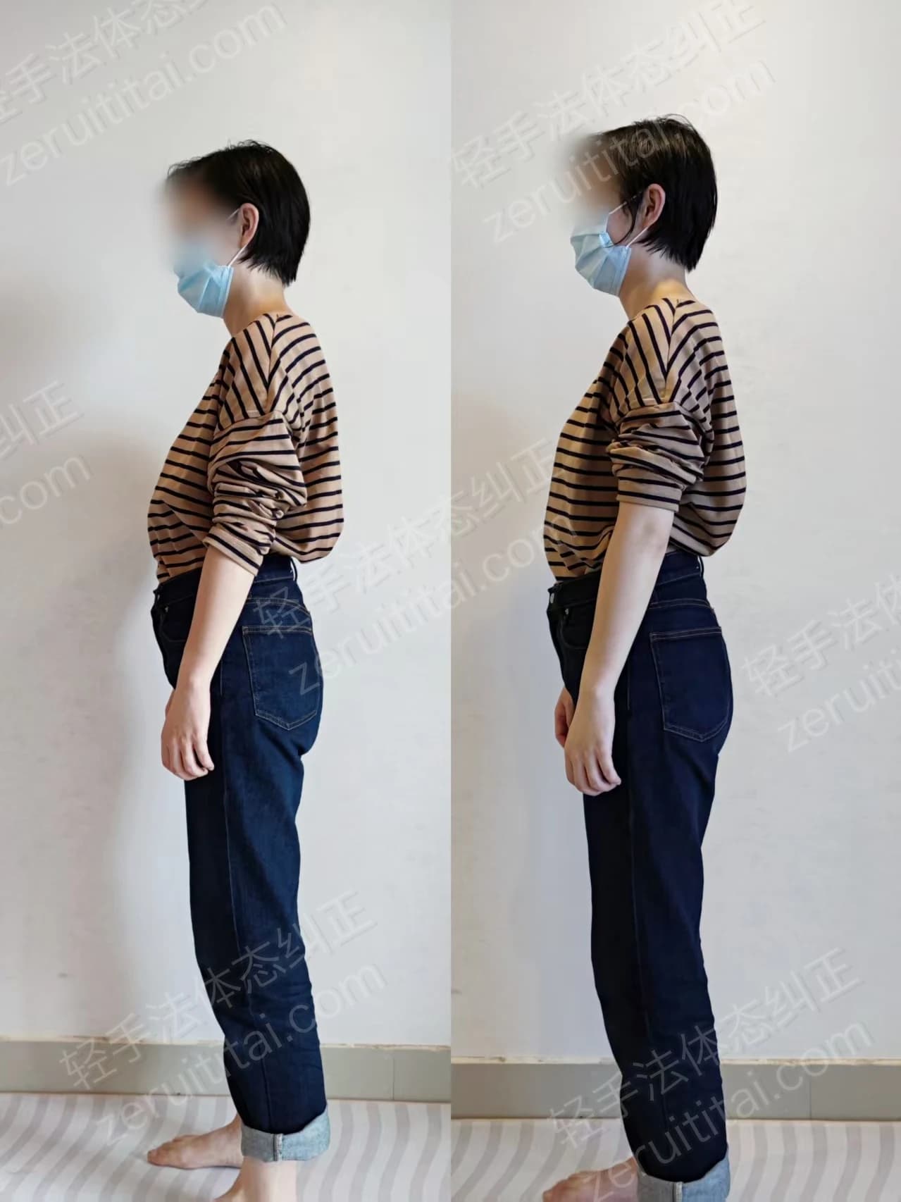 单次矫正案例对比 27