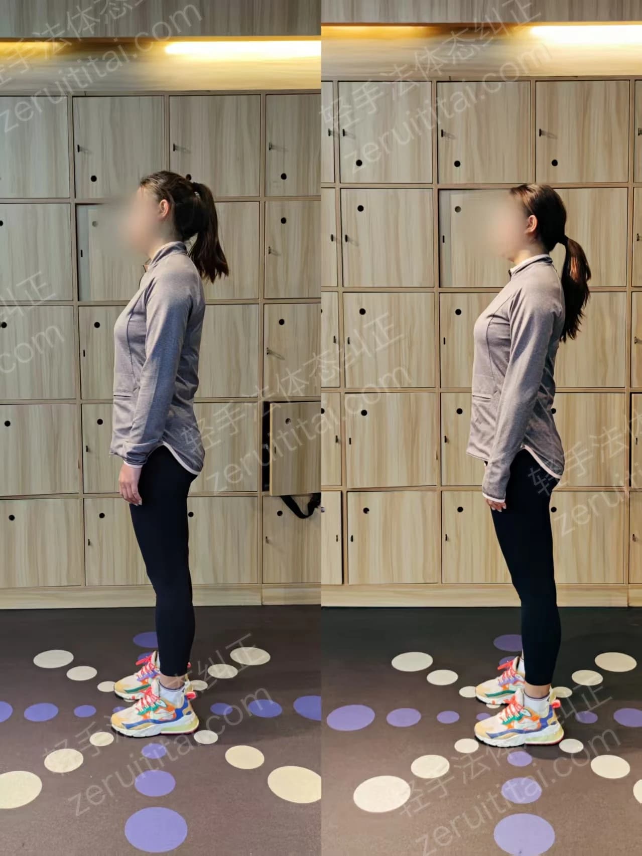 单次矫正案例对比 35