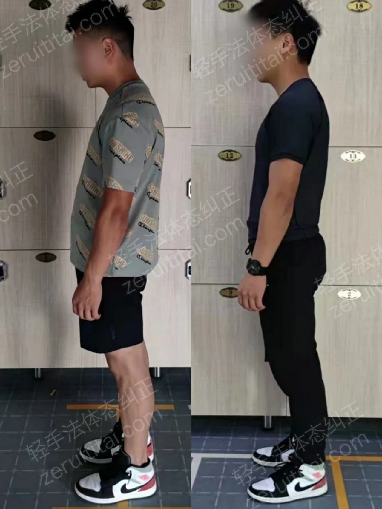 单次矫正案例对比 37