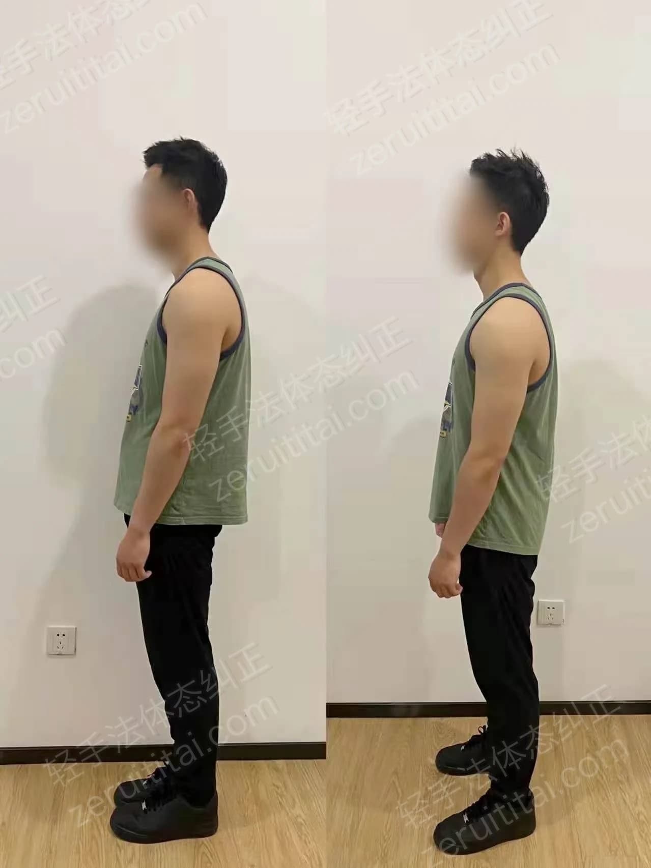 单次矫正案例对比 58