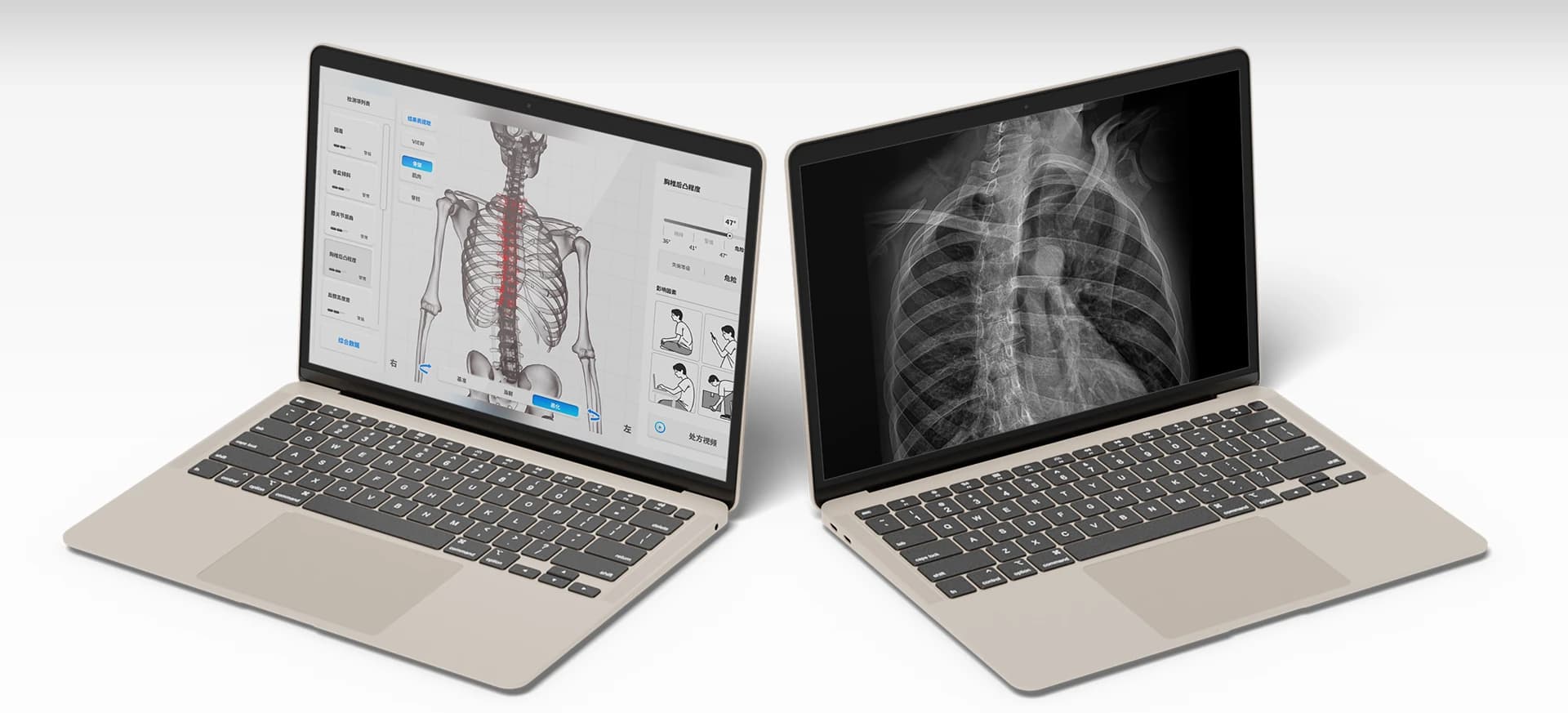 Motiphysio AI智能体态评估仪