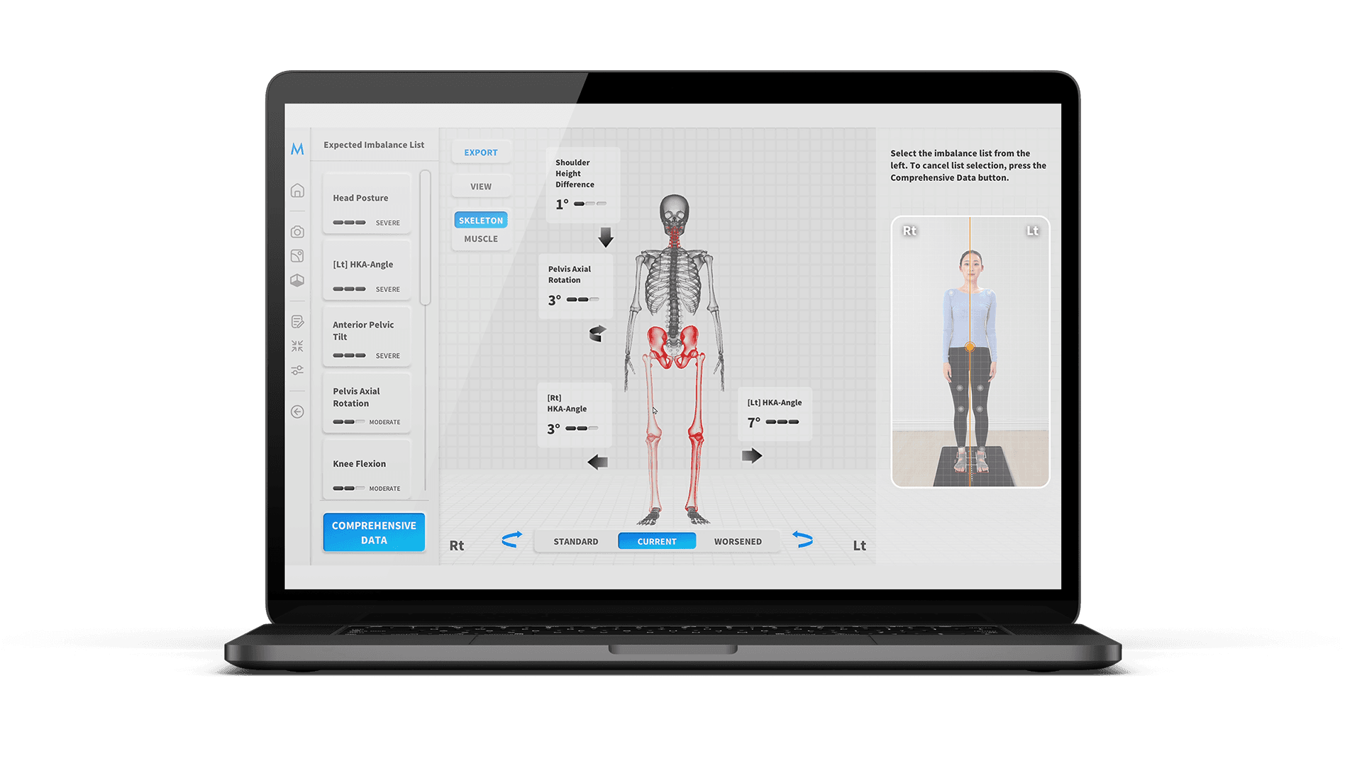 Moti Physio 3D体态评估界面